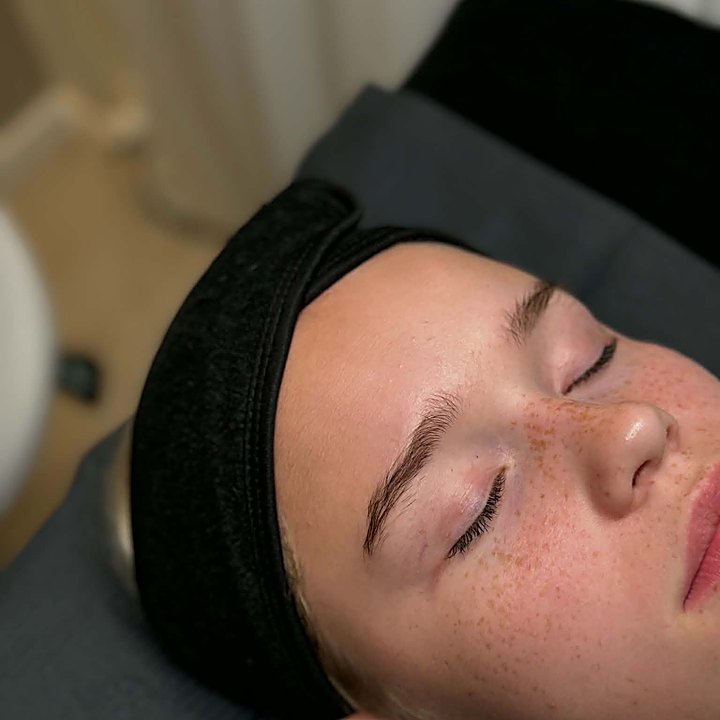 Före browlift i Mora